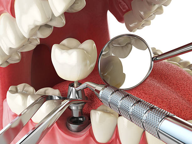 Best After-Hours Dental Trauma Care in Laurie, MO